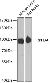 Anti-RPH3A Antibody (CAB6722)