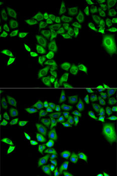 Anti-FMO3 Antibody (CAB1901)