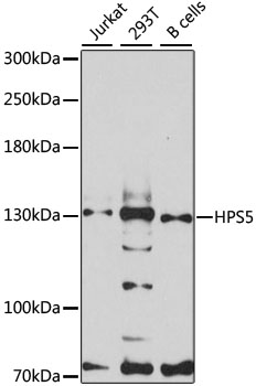 Anti-HPS5 Antibody (CAB12079)