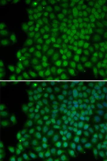 Anti-POLR1C Antibody (CAB0269)