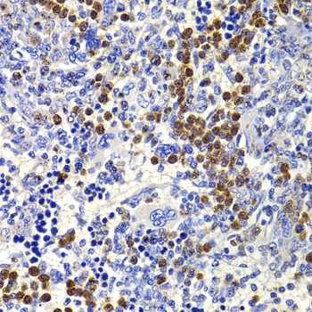 Anti-IL-21 Antibody (CAB7235)