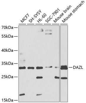 Anti-DAZL Antibody (CAB1114)