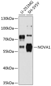 Anti-NOVA1 Antibody (CAB12030)