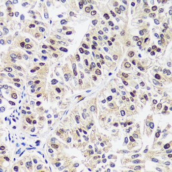 Anti-CAND1 Antibody (CAB14287)