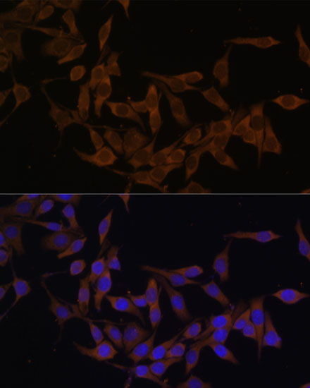 Anti-UBE2L3 Antibody (CAB4175)