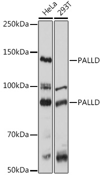 Anti-PALLD Antibody (CAB12362)