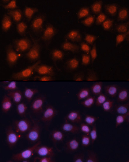 Anti-CDK11B Antibody (CAB12830)