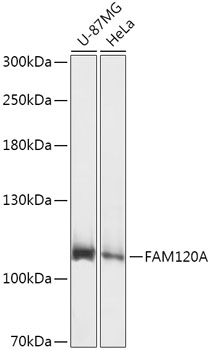 Anti-FAM120A Antibody (CAB17658)