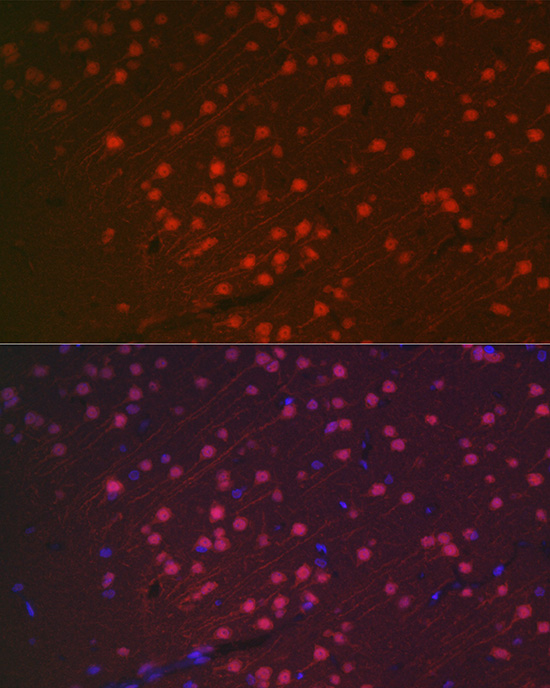 Anti-NeuN Antibody [KO Validated] (CAB0951)