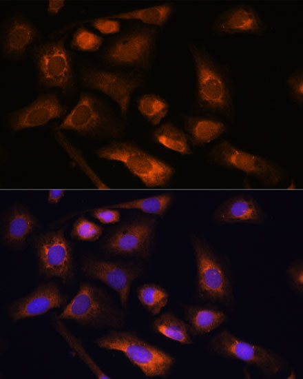 Anti-RPS13 Antibody (CAB15720)