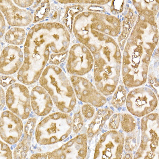 Immunohistochemistry of paraffin-embedded rat kidney using USP9Y Rabbit pAb at dilution of 1:150 (40x lens). Perform high pressure antigen retrieval with 10 mM citrate buffer pH 6. 0 before commencing with IHC staining protocol.