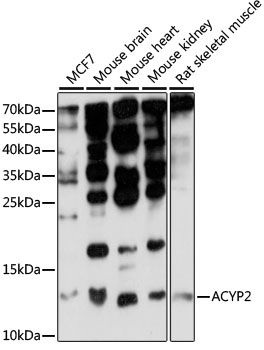 Anti-ACYP2 Antibody (CAB15636)