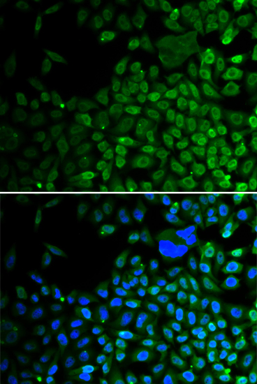 Anti-HDAC2 Antibody (CAB2084)