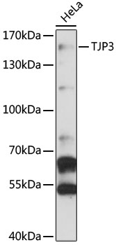 Anti-TJP3 Antibody (CAB13085)