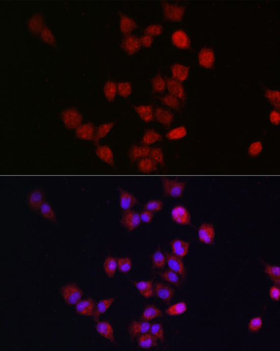 Anti-ANAPC11 Antibody (CAB15449)