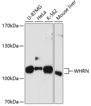 Anti-WHRN Antibody (CAB10773)