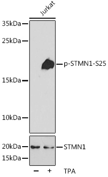 Anti-Phospho-Stathmin-S25 Antibody (CABP0220)