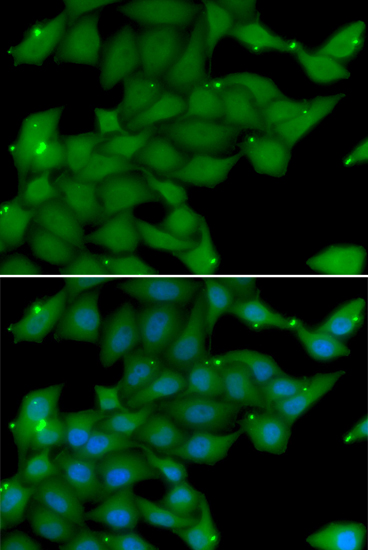 Anti-RASGRF1 Antibody (CAB6964)