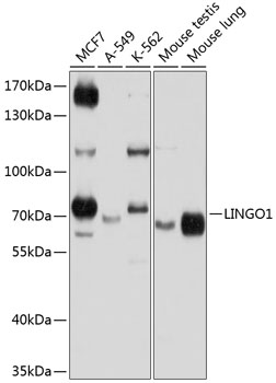 Anti-LINGO1 Polyclonal Antibody (CAB9369)