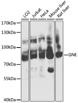Anti-GNE Polyclonal Antibody (CAB8570)