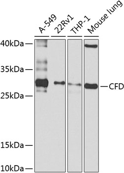 Anti-Complement factor D Polyclonal Antibody (CAB8117)