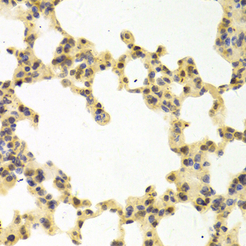 Anti-RANGAP1 Antibody (CAB5381)