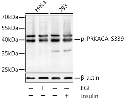 Anti-Phospho-PRKACA-S339 Antibody (CABP0558)