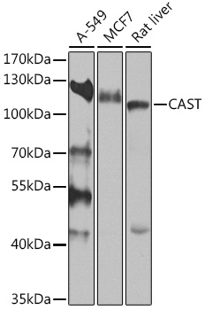 Anti-CAST Antibody (CAB16791)