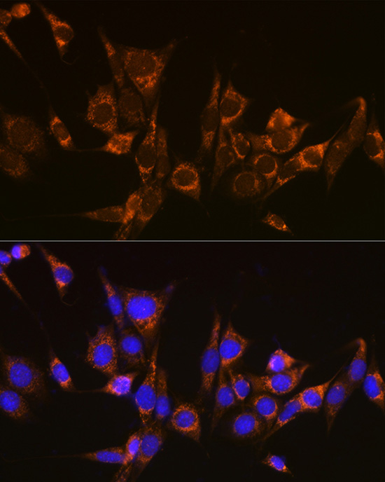 Anti-ATG3 Antibody (CAB5809)