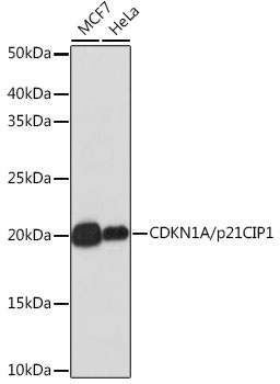 Anti-CDKN1A/p21CIP1 Antibody [KO Validated] (CAB19094)