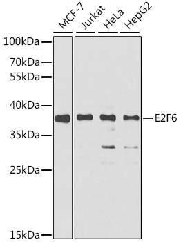 Anti-E2F6 Antibody (CAB6151)