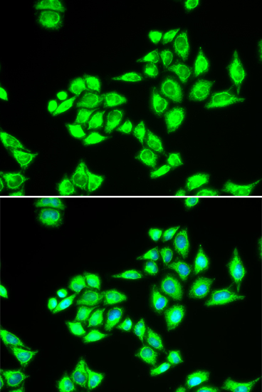 Anti-TPD52L1 Antibody (CAB6420)