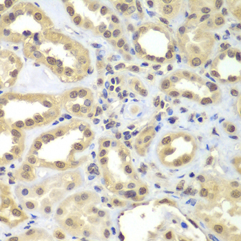 Anti-SUPT20H Antibody (CAB7374)