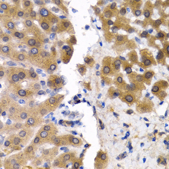 Anti-SCP2 Antibody (CAB5382)