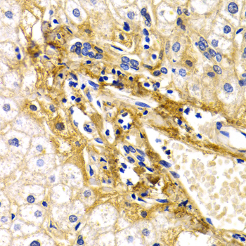 Anti-CFH Antibody (CAB2166)