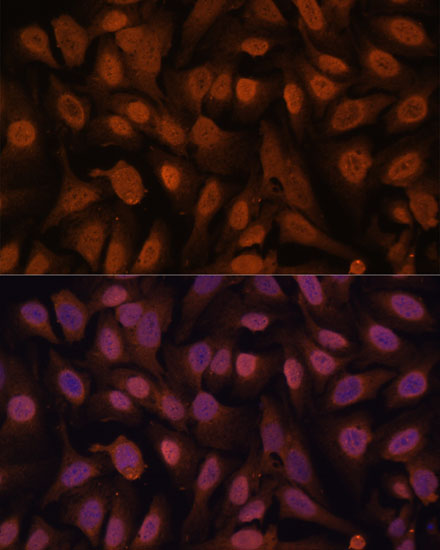 Anti-ZNF131 Antibody (CAB15331)