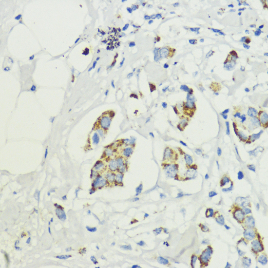 Anti-AKT1S1 Antibody (CAB6238)