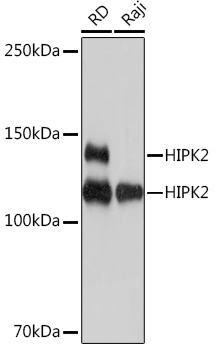 Anti-HIPK2 Antibody (CAB9552)