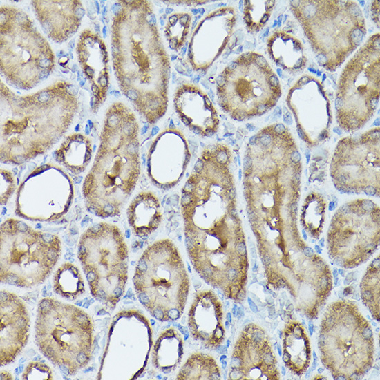 Anti-FXN / Frataxin Antibody (CAB1745)