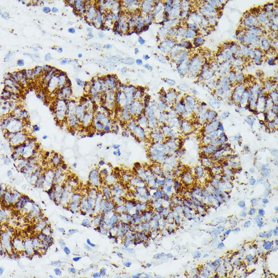 Anti-ETHE1 Antibody (CAB10142)