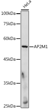 Anti-AP2M1 Antibody (CAB13962)