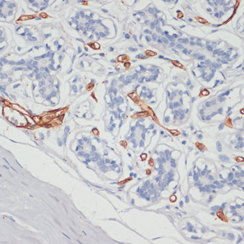 Anti-CD36 Antibody (CAB17339)