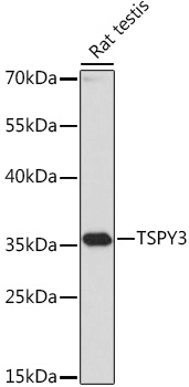 Anti-TSPY3 Antibody (CAB17886)