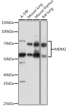 Anti-MDM2 Antibody (CAB13327)