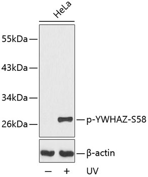 Anti-Phospho-YWHAZ-S58 Antibody (CABP0195)