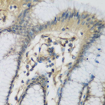 Anti-C1S Antibody (CAB6878)