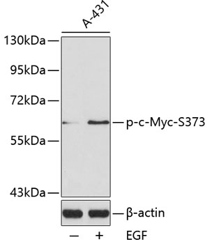 Anti-Phospho-MYC-S373 Antibody (CABP0132)