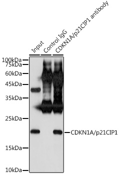 Anti-CDKN1A/p21CIP1 Antibody [KO Validated] (CAB2691)