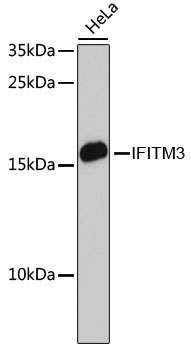 Anti-IFITM3 Antibody [KO Validated] (CAB13070)