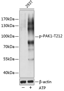 Anti-Phospho-PAK1-T212 Antibody (CABP0555)